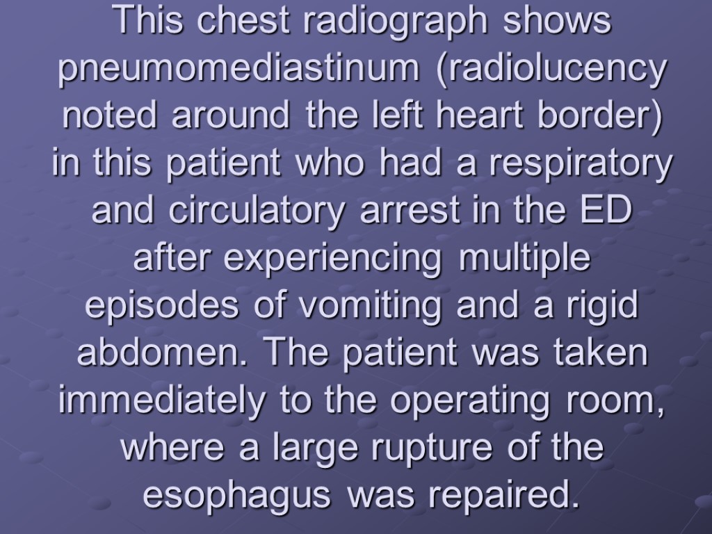 This chest radiograph shows pneumomediastinum (radiolucency noted around the left heart border) in this